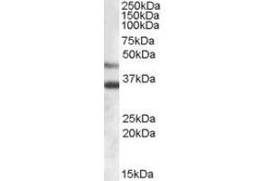 Image no. 1 for anti-Arylsulfatase B (ARSB) (Internal Region) antibody (ABIN374887) (Arylsulfatase B anticorps  (Internal Region))