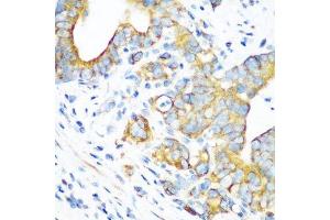 Immunohistochemistry of paraffin-embedded human stomach using MT-CO2 antibody.