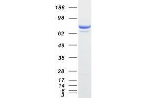 Validation with Western Blot
