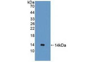 Detection of Recombinant UBQLN2, Human using Polyclonal Antibody to Ubiquilin 2 (UBQLN2) (Ubiquilin 2 anticorps  (AA 33-126))