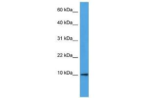 Western Blot showing DEFB4A antibody used at a concentration of 1-2 ug/ml to detect its target protein. (DEFB4A anticorps  (N-Term))