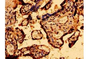 Immunohistochemistry of paraffin-embedded human placenta tissue using ABIN7146314 at dilution of 1:100 (MCU anticorps  (AA 155-233))