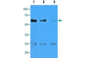 Western blot analysis of mouse muscle extracts (35 ug) with CASQ2 monoclonal antibody, clone AT4E10  at 1:500 (Lane 1), 1:1000 (Lane 2) and , 1:5000 (Lane 3) dilution.