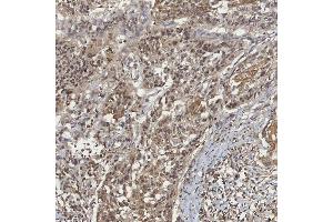 IHC analysis of mSin3A/SIN3A using anti-mSin3A/SIN3A antibody (ABIN7602504). (SIN3A anticorps  (AA 8-918))