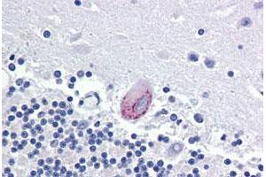 Immunohistochemical staining of human brain, cerebellum with LPCAT1 polyclonal antibody . (LPCAT1 anticorps  (Internal Region))