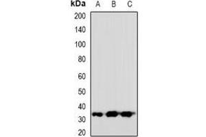 Western blot analysis of VGLL2 expression in HeLa (A), mouse heart (B), rat heart (C) whole cell lysates. (VGLL2 anticorps)