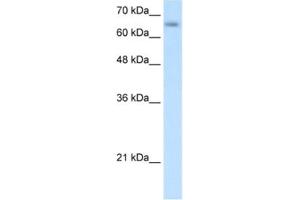 Western Blotting (WB) image for anti-Solute Carrier Family 39 (Zinc Transporter), Member 12 (SLC39A12) antibody (ABIN2462779) (SLC39A12 anticorps)