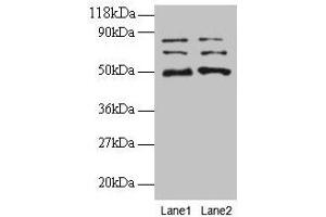 Western blot All lanes: VOPP1 antibody at 2 μg/mL Lane 1: EC109 whole cell lysate Lane 2: 293T whole cell lysate Secondary Goat polyclonal to rabbit IgG at 1/15000 dilution Predicted band size: 20, 19, 18 kDa Observed band size: 50, 70, 80 kDa (VOPP1 anticorps  (AA 23-172))