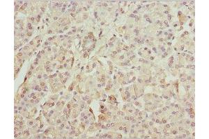 IHC analysis of paraffin-embedded human pancreatic tissue using ZFYVE1 antibody (1/100 dilution). (ZFYVE1 anticorps  (AA 1-280))