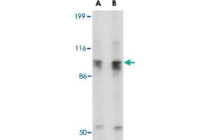 Western blot analysis of SLITRK6 in SK-N-SH cell lysate with SLITRK6 polyclonal antibody  at (A) 0. (SLITRK6 anticorps  (C-Term))