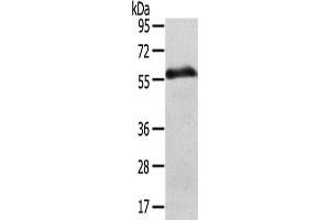 Gel: 8 % SDS-PAGE,Lysate: 40 μg,Lane: Human normal stomach tissue,Primary antibody: ABIN7192491(SLC43A2 Antibody) at dilution 1/200 dilution,Secondary antibody: Goat anti rabbit IgG at 1/8000 dilution,Exposure time: 5 minute (SLC43A2 anticorps)