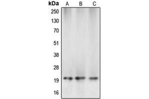 Western blot analysis of Caspase 5 p20 expression in MCF7 (A), mouse kidney (B), rat liver (C) whole cell lysates. (Caspase 5 p20 anticorps  (Center))
