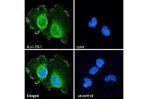 (ABIN570961) Immunofluorescence analysis of paraformaldehyde fixed U251 cells, permeabilized with 0. (TJP1 anticorps  (Internal Region))