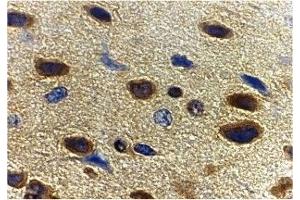 Immunohistochemistry (IHC) image for anti-Adiponectin (ADIPOQ) (C-Term) antibody (ABIN1030223) (ADIPOQ anticorps  (C-Term))