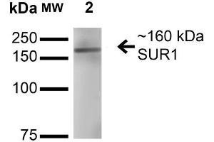 Western Blot analysis of Rat Brain Membrane showing detection of ~160 kDa SUR1 protein using Mouse Anti-SUR1 Monoclonal Antibody, Clone S289-16 .