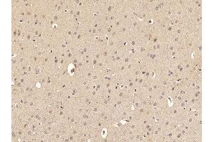 Paraformaldehyde-fixed, paraffin embedded Rat brain Antigen retrieval by boiling in sodium citrate buffer (pH6.