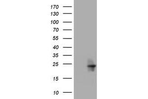 Image no. 1 for anti-Visinin-Like 1 (VSNL1) (AA 2-191) antibody (ABIN1491135) (VSNL1 anticorps  (AA 2-191))