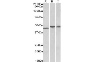 ABIN334503 (1µg/ml) staining of Human Cerebellum (A), Frontal Cotex (B) and Hippocampus (C) lysates (35µg protein in RIPA buffer).
