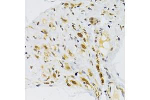 Immunohistochemistry of paraffin-embedded human stomach using RPL13 Antibody (ABIN2559760) at dilution of 1:100 (40x lens). (RPL13 anticorps)