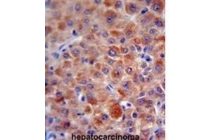 Immunohistochemistry (IHC) image for anti-Complement Factor H (CFH) antibody (ABIN5015561) (Complement Factor H anticorps)