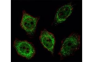 Fluorescent image of U251 cell stained with PGP 9.