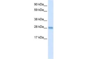 Western Blotting (WB) image for anti-BCL2-Like 1 (BCL2L1) antibody (ABIN2463654) (BCL2L1 anticorps)