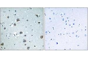 Immunohistochemistry analysis of paraffin-embedded human brain tissue, using GNAL Antibody.