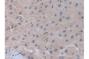 Detection of D2HGDH in Human Liver Tissue using Polyclonal Antibody to D2-Hydroxyglutarate Dehydrogenase (D2HGDH)