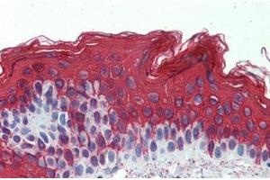 Human Skin: Formalin-Fixed, Paraffin-Embedded (FFPE) (Cytokeratin 1 anticorps  (C-Term))