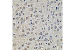Immunohistochemistry of paraffin-embedded rat brain using DNAJA3 Antibody.