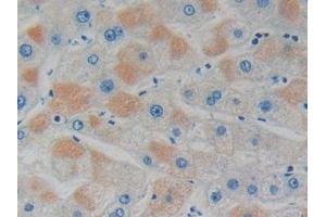 Detection of GDI1 in Human Liver Tissue using Polyclonal Antibody to GDP Dissociation Inhibitor 1 (GDI1) (GDI1 anticorps  (AA 1-274))