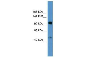 Western Blot showing Lp (a) antibody used at a concentration of 1-2 ug/ml to detect its target protein. (LPA anticorps  (Middle Region))