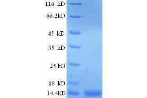 SDS-PAGE (SDS) image for Prostate Stem Cell Antigen (PSCA) (AA 21-95) protein (His tag) (ABIN1047564)