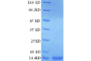 SDS-PAGE (SDS) image for Prostate Stem Cell Antigen (PSCA) (AA 21-95) protein (His tag) (ABIN1047564) (PSCA Protein (AA 21-95) (His tag))