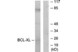 Western blot analysis of extracts from 293 cells, treated with UV, using BCL-XL (Ab-62) Antibody. (BCL2L1 anticorps  (AA 28-77))