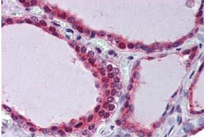 Thyroid, Human: Formalin-Fixed, Paraffin-Embedded (FFPE) (THRSP anticorps)