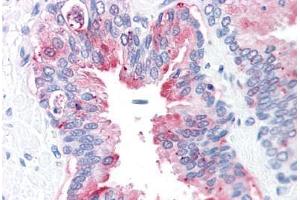 Human Prostate: Formalin-Fixed, Paraffin-Embedded (FFPE) (ADAM20 anticorps  (Internal Region))