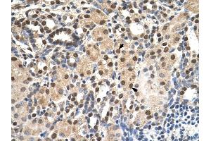 ANP32E antibody was used for immunohistochemistry at a concentration of 4-8 ug/ml to stain EpitheliaI cells of renal tubule (arrows) in Human Kidney. (ANP32E anticorps)
