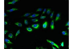 Immunofluorescent analysis of Hela cells using ABIN7145930 at dilution of 1:100 and Alexa Fluor 488-congugated AffiniPure Goat Anti-Rabbit IgG(H+L)