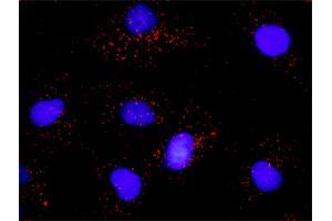Proximity Ligation Analysis of protein-protein interactions between PTK2 and PLCG1.