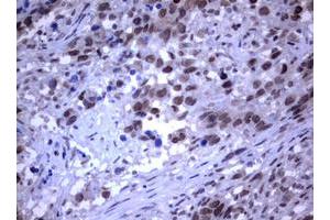 Image no. 3 for anti-RAS Guanyl Releasing Protein 3 (Calcium and DAG-Regulated) (RASGRP3) (AA 380-690) antibody (ABIN1491477)