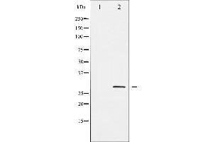 Western blot analysis of SNAI1 phosphorylation expression in HT29 whole cell lysates,The lane on the left is treated with the antigen-specific peptide. (SNAIL anticorps  (pSer246))