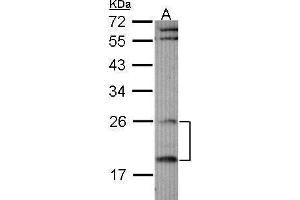 WB Image Sample (30 ug of whole cell lysate) A: Raji 12% SDS PAGE antibody diluted at 1:1000