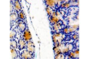 Used in DAB staining on fromalin fixed paraffin-embedded bowels tissue (eIF4EBP1 anticorps  (AA 2-117))