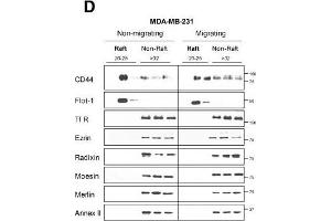 CD44 affiliation with lipid rafts is reduced during migration of highly-invasive breast cancer cells.