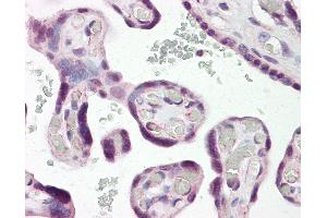 Anti-DLX3 antibody IHC of human placenta. (DLX3 anticorps  (N-Term))