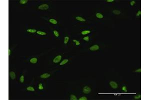 Immunofluorescence of purified MaxPab antibody to SATB1 on HeLa cell. (SATB1 anticorps  (AA 1-763))
