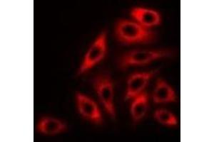Immunofluorescent analysis of RPLP0 staining in K562 cells. (RPLP0 anticorps)