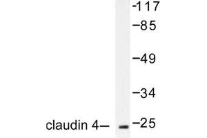 Image no. 2 for anti-Claudin 4 (CLDN4) antibody (ABIN265363)