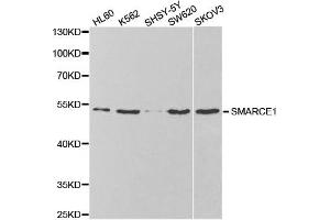 Western Blotting (WB) image for anti-SWI/SNF Related, Matrix Associated, Actin Dependent Regulator of Chromatin, Subfamily E, Member 1 (SMARCE1) antibody (ABIN1876549) (SMARCE1 anticorps)